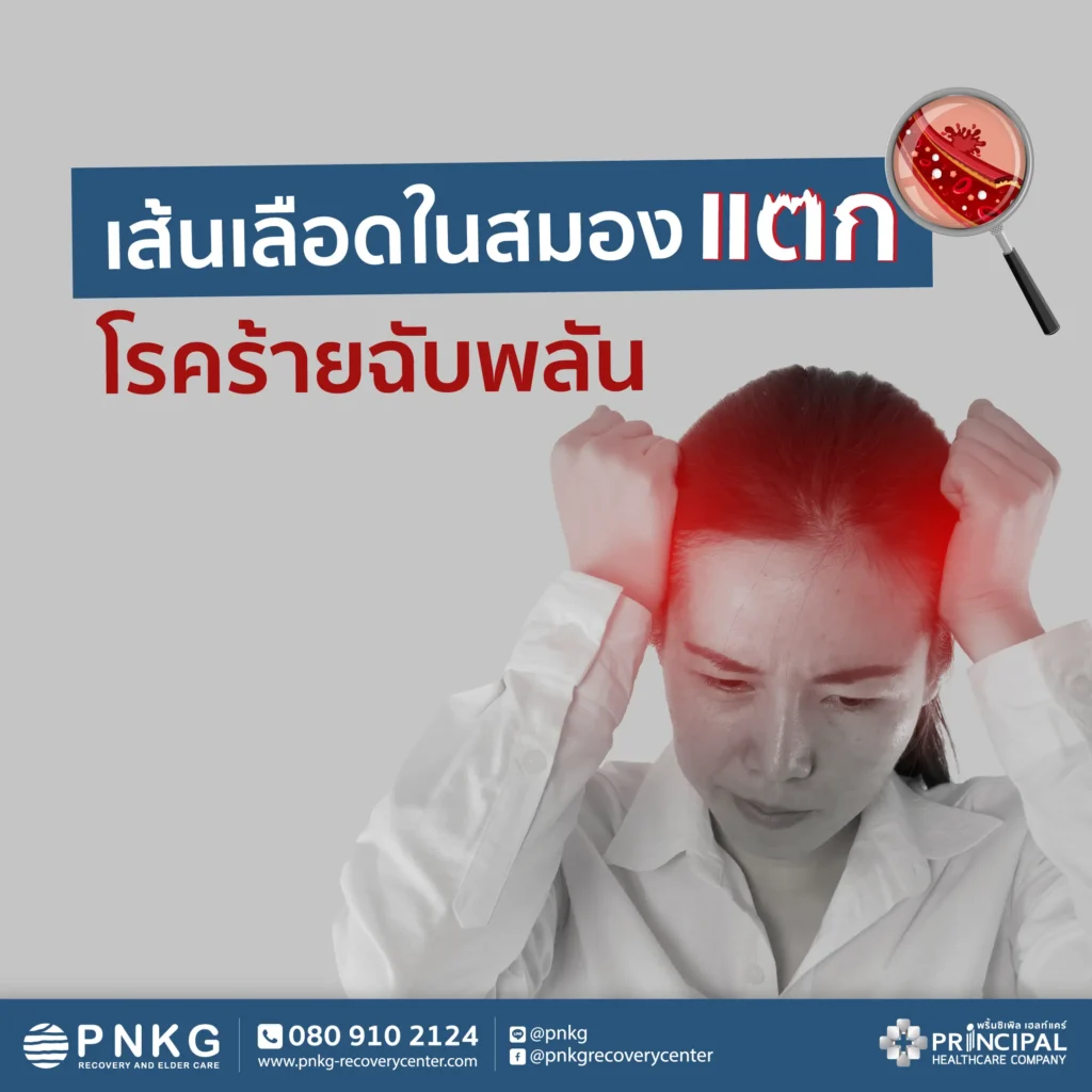 เส้นเลือดในสมองแตก โรคร้ายฉับพลัน สาเหตุ อาการ และการรักษา